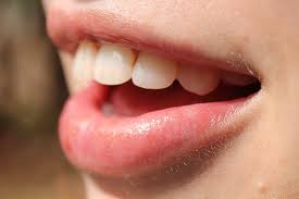 Achieve Better Dental Health thru Right Oral Hygiene