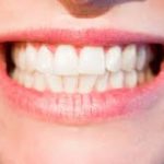 affordable dentures columbus oh