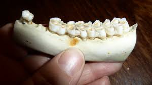 Advisable Tips in Handling Broken Tooth - Advisable Tips in Handling Broken Tooth