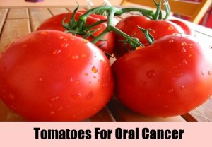 Tomatoes The Best Fighter for Oral Cancer 300x208 - Tomatoes – The Best Fighter for Oral Cancer