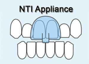 The Best of NTI Appliance 300x216 - The Best of NTI Appliance