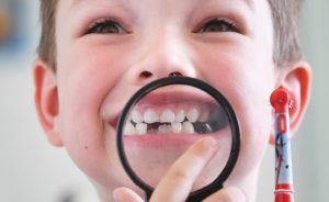 Common Dental Problems to Kids2 300x184 - Common Dental Problems to Kids